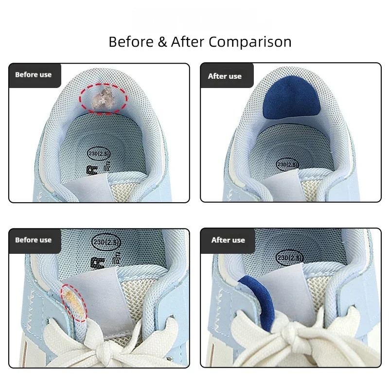 6 Peças Adesivos Protetores An - Life Sneaker Care avaliação e preço